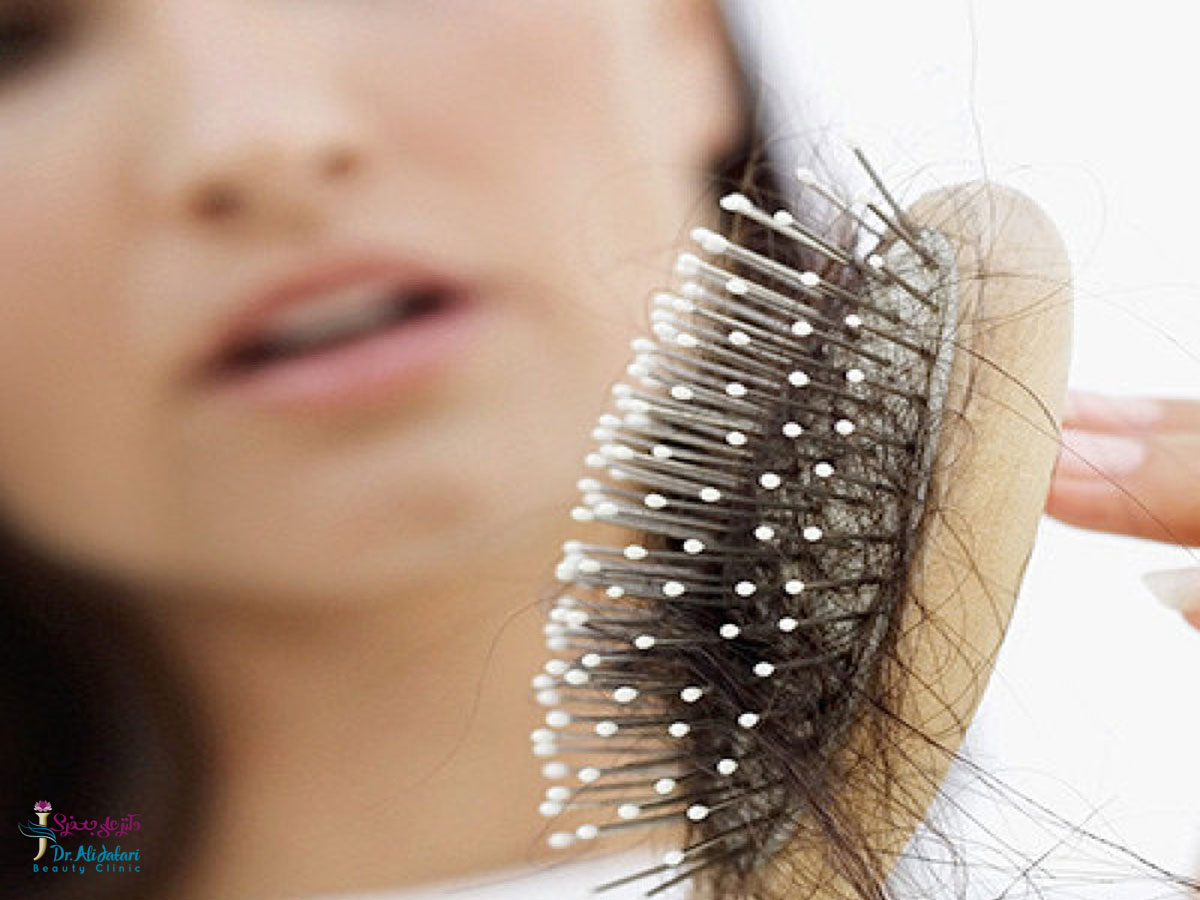 نکات طلایی درباره ریزش مو/ آیا ریزش مو درمان دارد؟ 